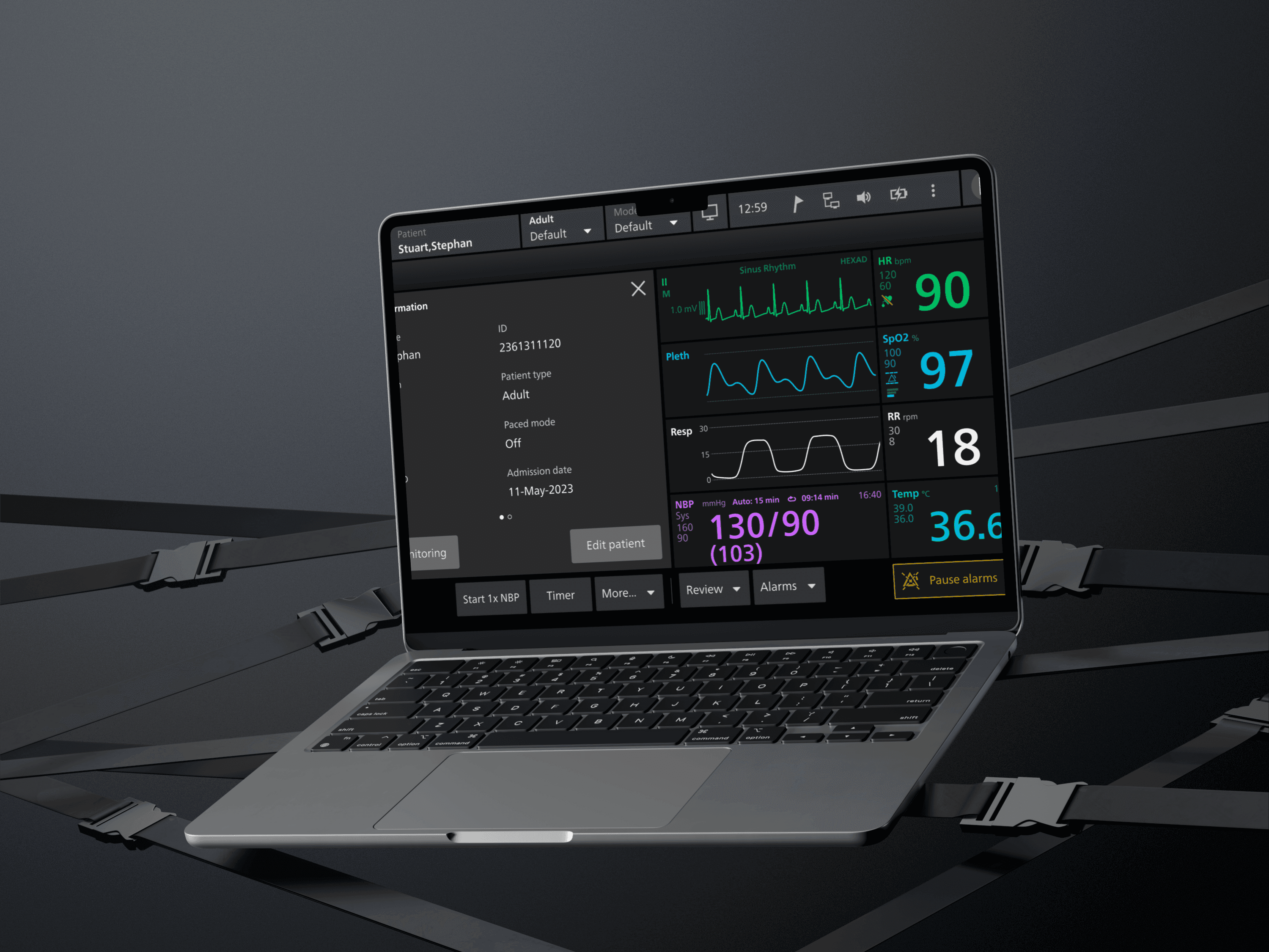 Philips ICU monitor interface case study cover